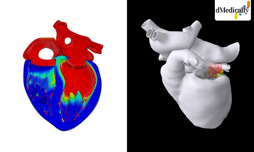 Dassault Systèmes impulsa la nueva fase del Proyecto Living Heart con gemelos virtuales basados en IA